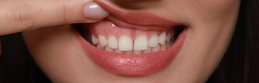 Zirconia crowns on basal implants: the future of smile transformations